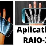 Aplicativo que simula Raio-X no celular